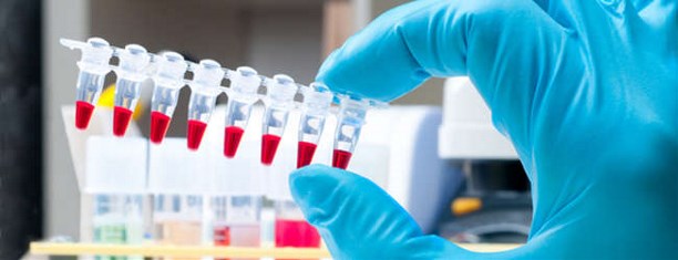 Сдать анализы крови на гепатит в туле