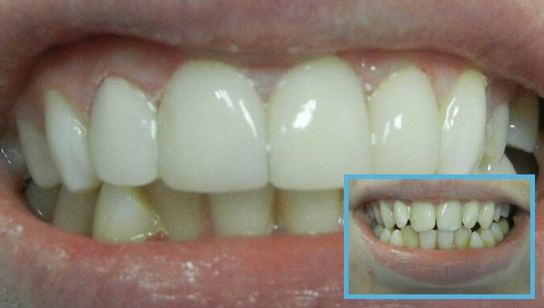 Зубы лечение в тульской области thumbnail