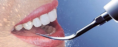 Как вылечить зубы бесплатно в туле